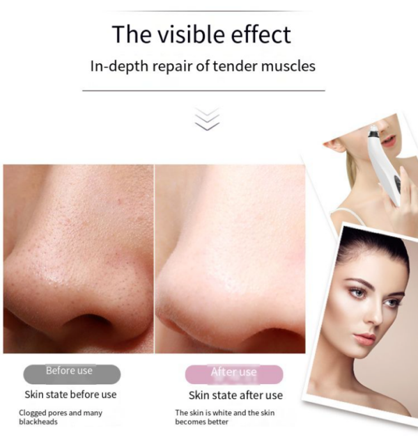 Electric Blackhead Remover And  Face Cleaner With Diamond Pore Vacuum Suction For White Heads